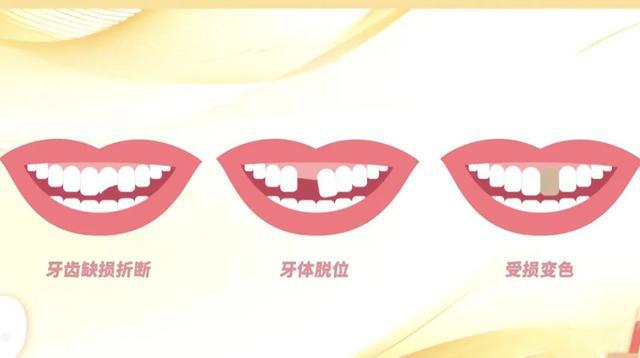 只是爱美！有些人一定要做尊龙凯时链接牙齿正畸不(图1)